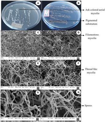 Promising bioactive metabolites of mangrove inhabitant Streptomyces tauricus and prostate cancer PC3 cell inhibition by antimicrobial peptides